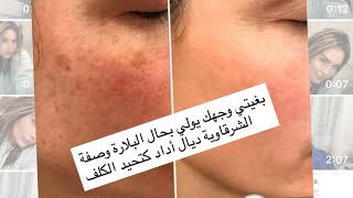 Wasfa Laklefff Dial Aded