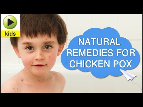 Video: How To Relieve Itching With Chickenpox In A Child: The Best Remedies, Tips