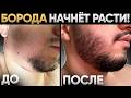 Не растёт борода? ПРОСТО ПОВТОРИ! Результаты средства для роста бороды за 4 месяца