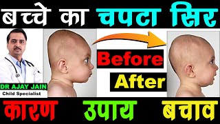 Flat Head of Baby | बच्चे का चपटा सर क्यों होता है ? | Dr Ajay Jain screenshot 2