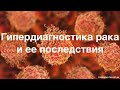 Гипердиагностика рака и ее последствия