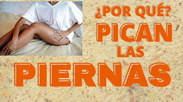 ¿Por qué me pican tanto las piernas?