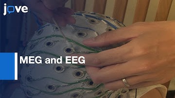 MEG and EEG to detect Interictal HFOs in Pediatric Epilepsy | Protocol Preview