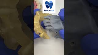 Tooth Supported Pin Guide over Bone Reduction Guide #dentalimplants #smiledesigndental #dentalarch
