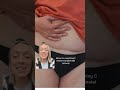 This is why losing weight might NOT fix your C-section belly