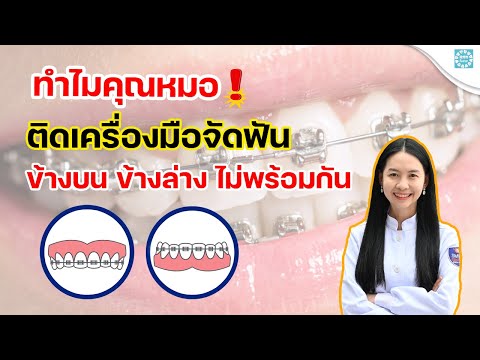 วีดีโอ: 4 วิธีในการบลัชออนฟันที่แหลมคม