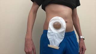 كيف تغير كيس ‏Stoma Care  