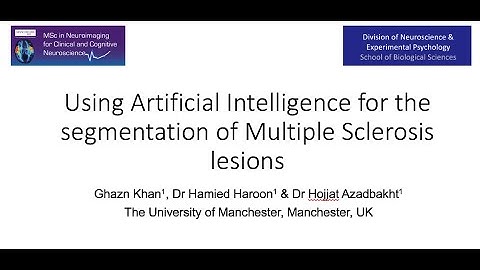 Using Artificial Intelligence for the segmentation of Multiple Sclerosis lesions
