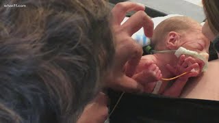 A glimpse of life in the NICU at Norton Children's Hospital