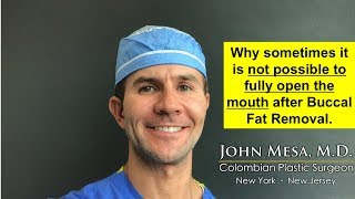 Can't Open Mouth After Buccal Fat Removal? | Plastic Surgeon NYC