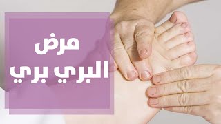 ما هو مرض البري بري؟ وما هي أبرز 3 أعراض له؟