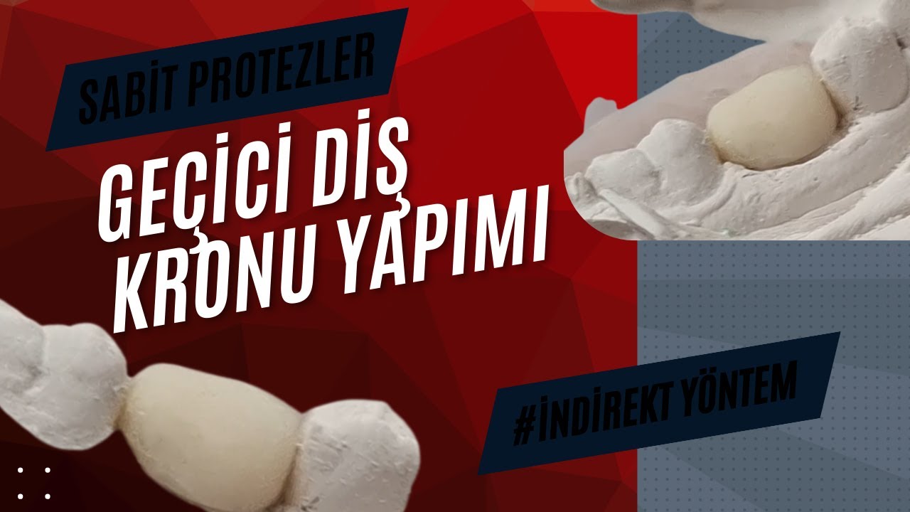 Geçici Kron Yapımı