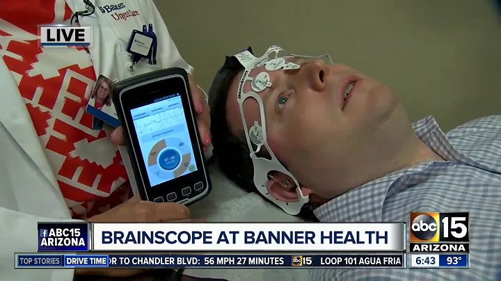 How does the Brainscope work?