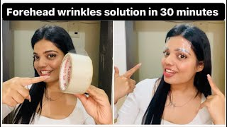 Get rid of forehead wrinkles in 30 minutes at home | beauty’s crown