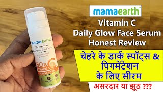 Mamaearth Daily glow Vitamin C Face Serum Review | 2 month Result about Pigmentation