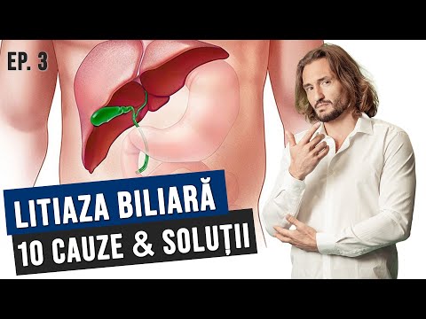 Dr Cezar: Probleme biliare ep 3: 10 cauze si solutii [Afla si tu!]