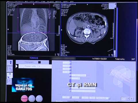 Video: Diferența Dintre ESR RMN și RMN