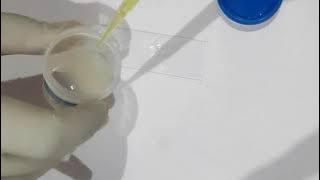 Semen Analysis in Hindi | Semen Test | Semen Test Report | Sperm Count | Male Semen Test | LABOeX...