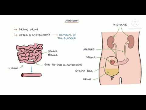 Understanding Stomas