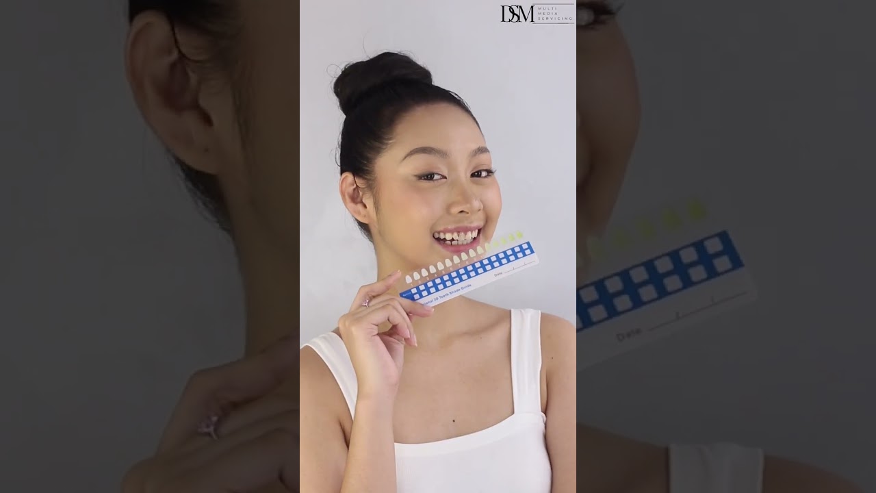 VIVID SMILE Teeth whitening Ads