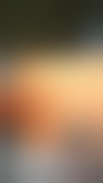 Penile enlargement surgery and Microscopic Varicocelectomy by Dr Araz Bayramov #andrologist #penis