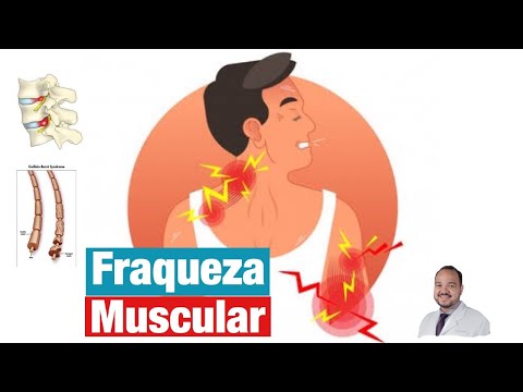 Vídeo: Fraqueza Nas Pernas: 11 Causas, Sintomas E Tratamentos