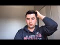 How to Recover Missing Google Reviews Fast in 2026