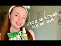 Уход за проблемной кожей / Уход за кожей после акне
