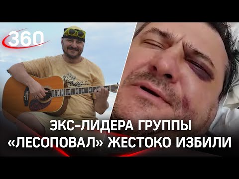 «Артистишка погорелого театра»: Руслана Казанцева жестоко избили после концерта в отеле в Сочи