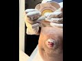 Colostomy Bag Change with Me💕