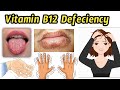 Symptoms of Vitamin B12 Defeciency