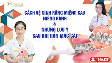Gắn mắc cài niềng răng - Lưu ý sau gắn, chăm sóc răng niềng