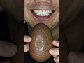ASMR | KitKat “Have a Break” Chocolate Egg 🍫 #DoctorTristanPeh #ASMR