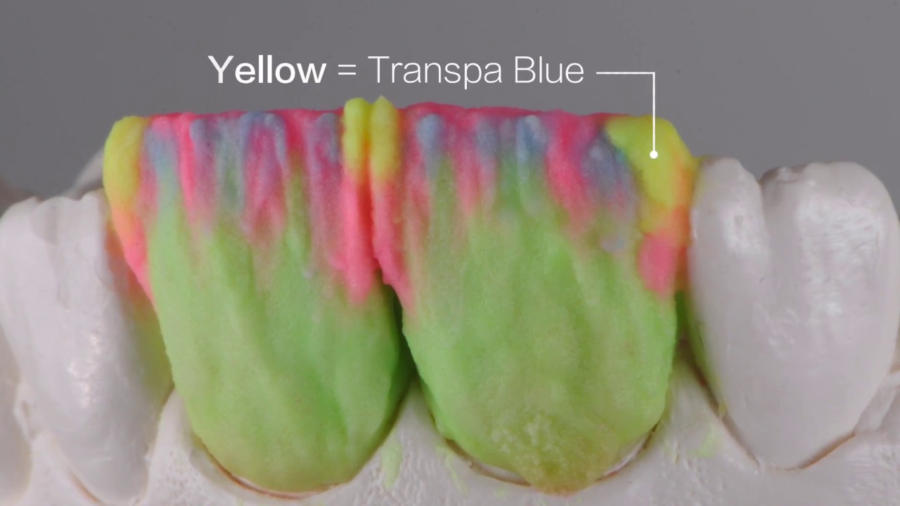 Power Dentine Build Up