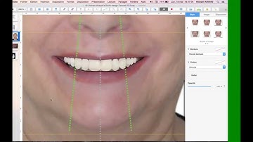 Architectural Smile Design