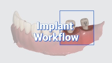 Implant Workflow