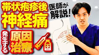 帯状疱疹後神経痛（PHN） | 慢性痛治療の専門医による痛みと身体