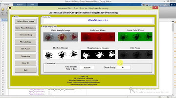 Matlab Code for Blood Group Detection using Image Processing