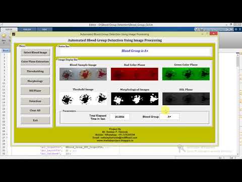 Matlab Code for Blood Group Detection using Image Processing