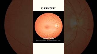 Eye Expert Knowledge 😲#eyes #optometrist #eyecareprofessional #eyespecialist #eyediseases