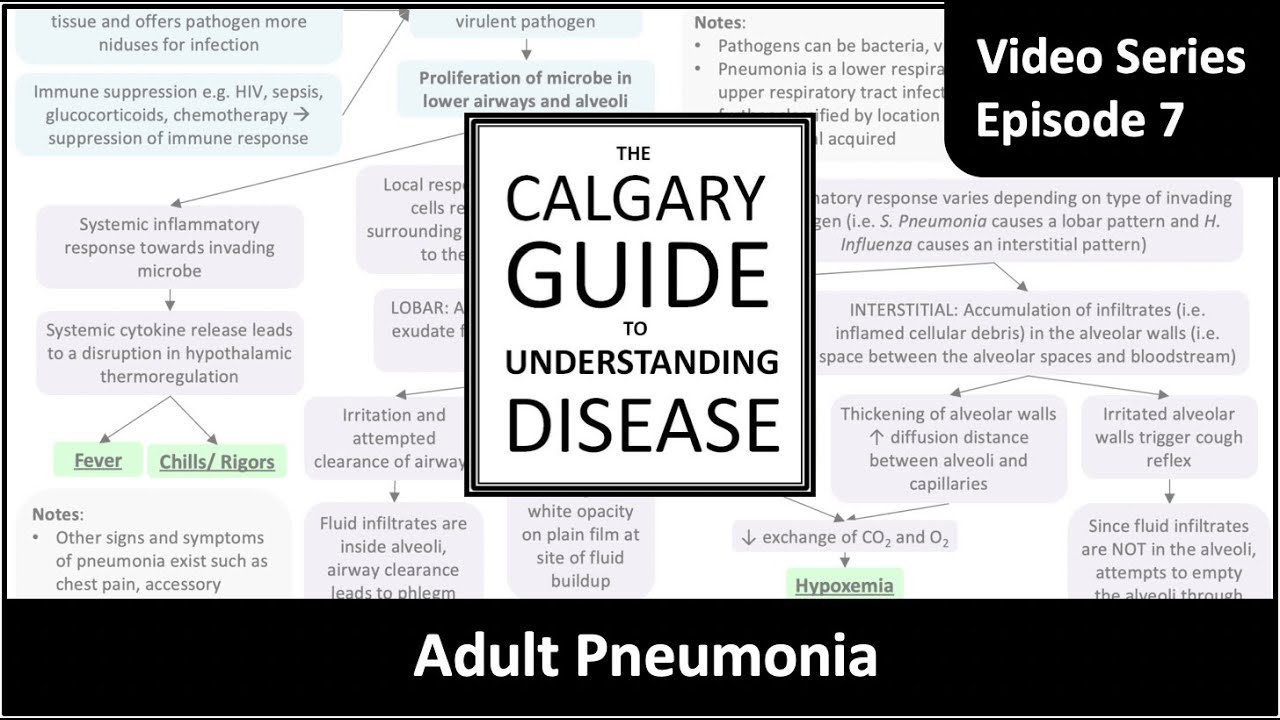Adult pneumonia