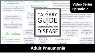 Adult pneumonia