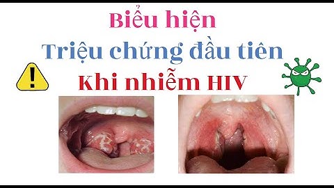 Biễu hiện, triệu chứng đầu tiên nhiễm HIV/ Giai đoạn cửa sổ