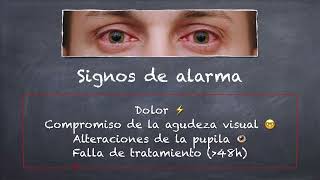 Oftalmología: Ojo rojo