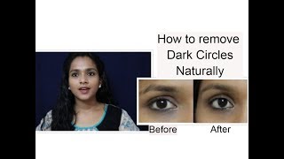 How To Remove UNDER EYE DARK CIRCLES NATURALLY - 100% RESULT IN 7 DAYS.