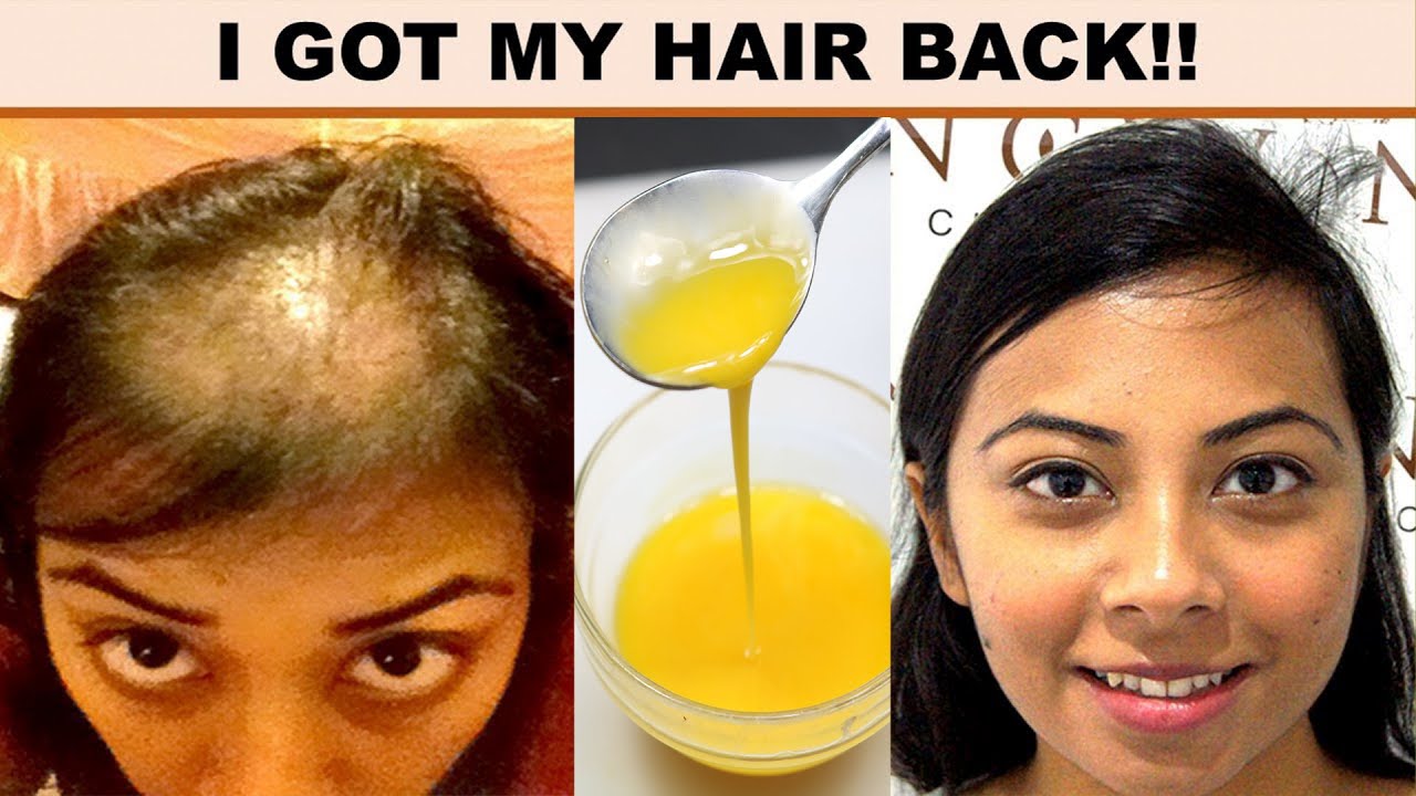  Hair Fast Regrowth Naturally In Short Time Period Only With This ...