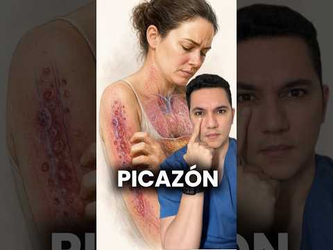 ¡Alerta! Picazón causada por enfermedades internas. #dermatologia #dermatologo #medicina #shorts