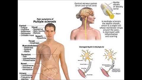 The Walk to Freedom Multiple Sclerosis 2019!
