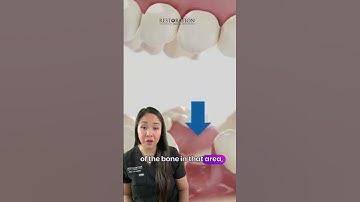 🦷 What happens when you don’t replace a missing tooth?