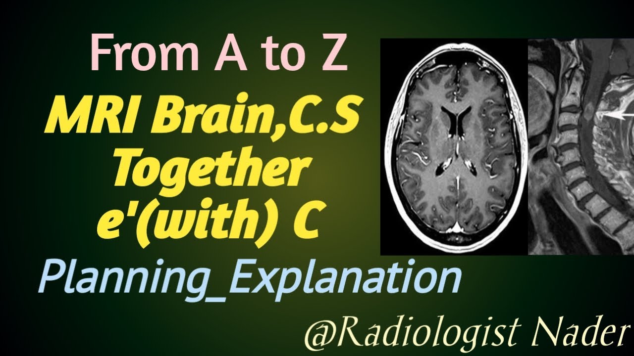 #رنين_مغناطيسي_علي_المخ_والفقرات_العنقية_بالصبغة|التصلب المتعدد|تخطيط|شرح